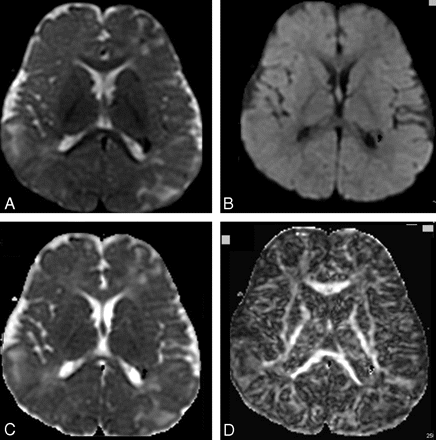 Fig 1.