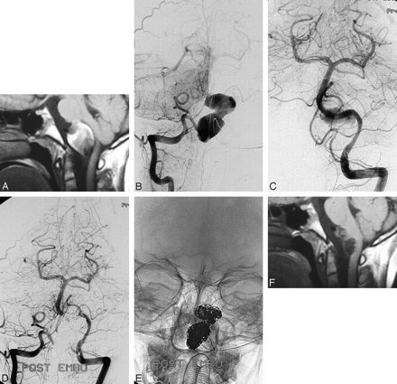 Fig 3.