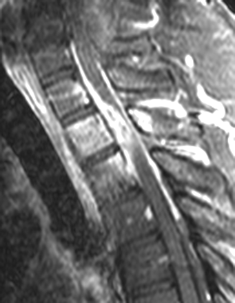Fig 2.