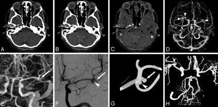 Fig 1.