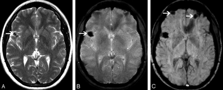 Fig 3.