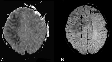 Fig 9.