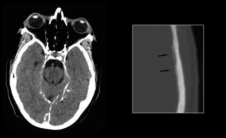 Fig 3.