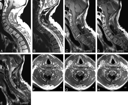 Fig 3.