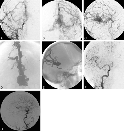 Fig 2.