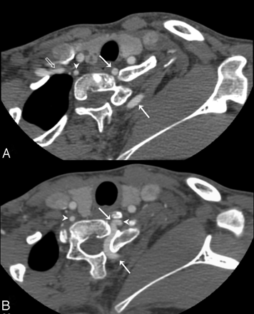 Fig 2.