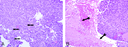 Fig 2.