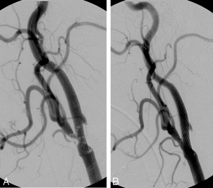 Fig 3.