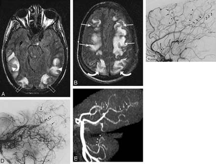 Fig 1.