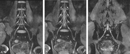 Fig 2.