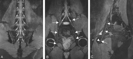 Fig 4.