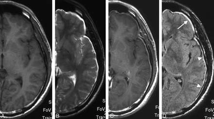 Fig 1.