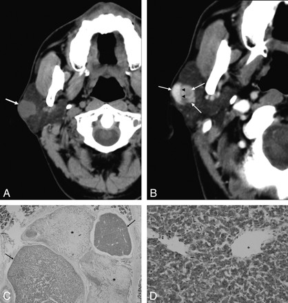 Fig 4.