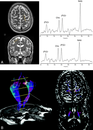 Fig 1.