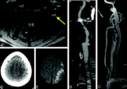 Fig 2.