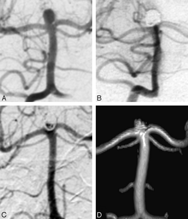 Fig 3.