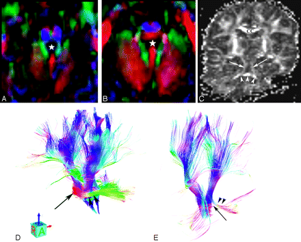 Fig 3.