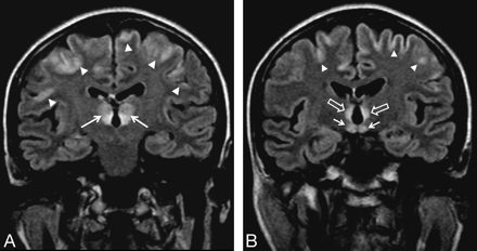 Fig 2.