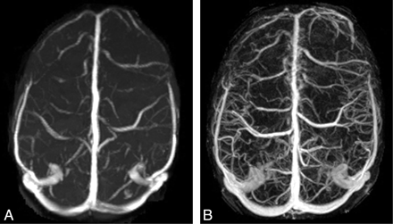 Fig 3.