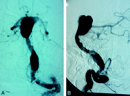 Fig 1.