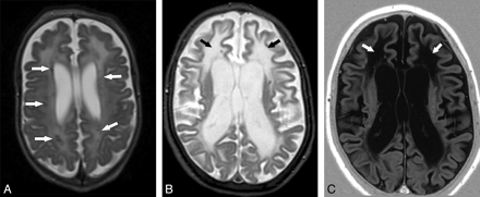 Fig 1.