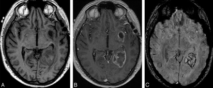 Fig 20.