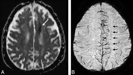 Fig 7.