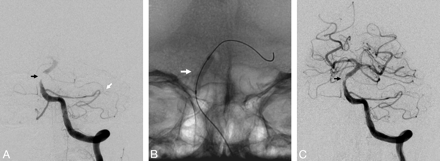 Fig 5.