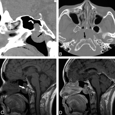 Fig 1.