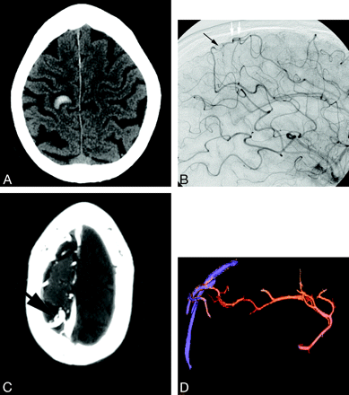 Fig 1.