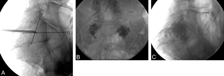 Fig 2.