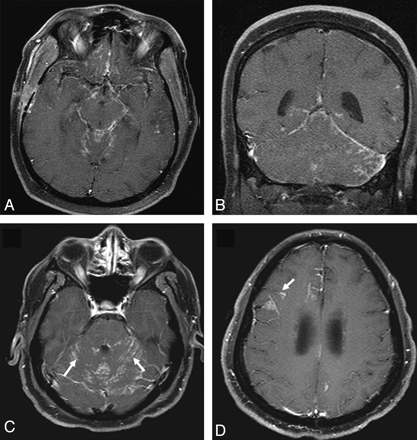 Fig 3.