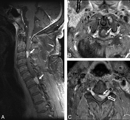 Fig 6.