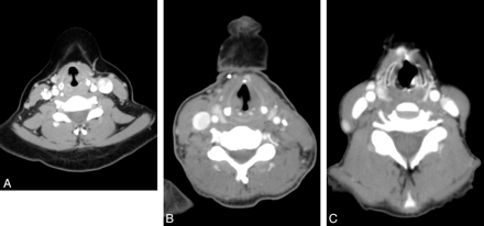 Fig 2.