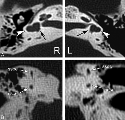 Fig 1.