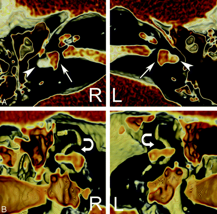 Fig 2.