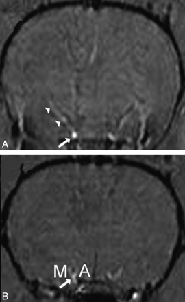 Fig 2.