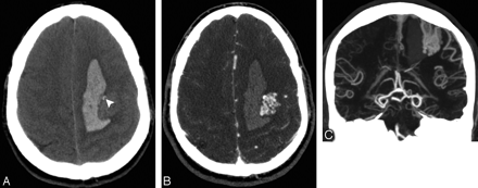 Fig 2.