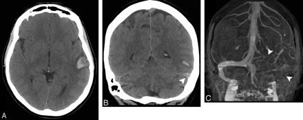 Fig 4.