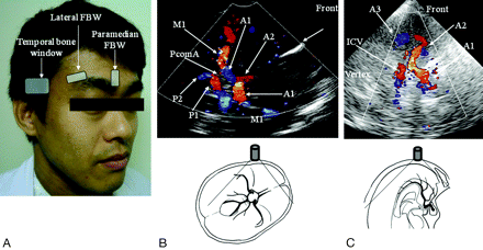   Fig 1. 