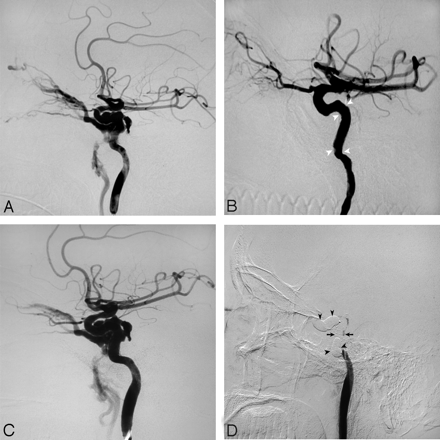 Fig 3.