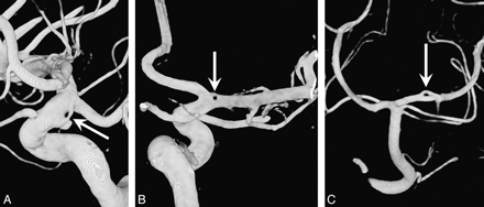 Fig 3.