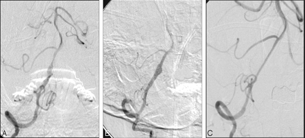 Fig 2.