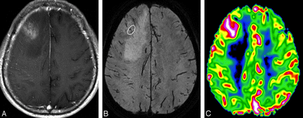 Fig 3.