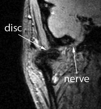 Fig 3.