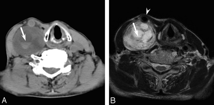 Fig 1.