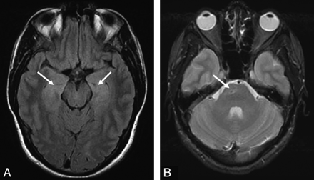   Fig 1. 