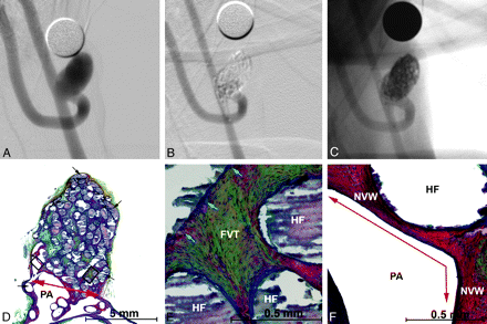 Fig 4.