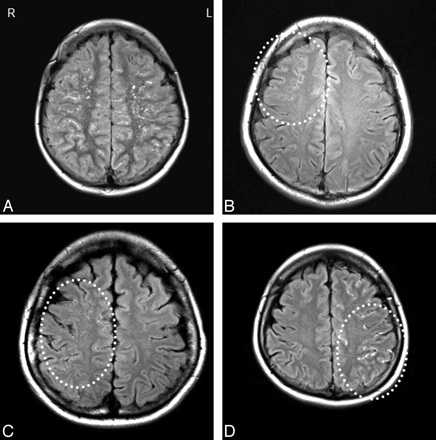 Fig 1.