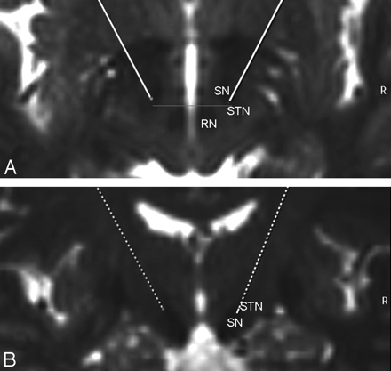 Fig 1.